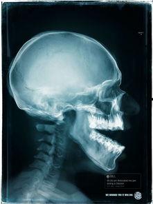 吃瓜把下巴脱臼,揭秘吃瓜安全指南